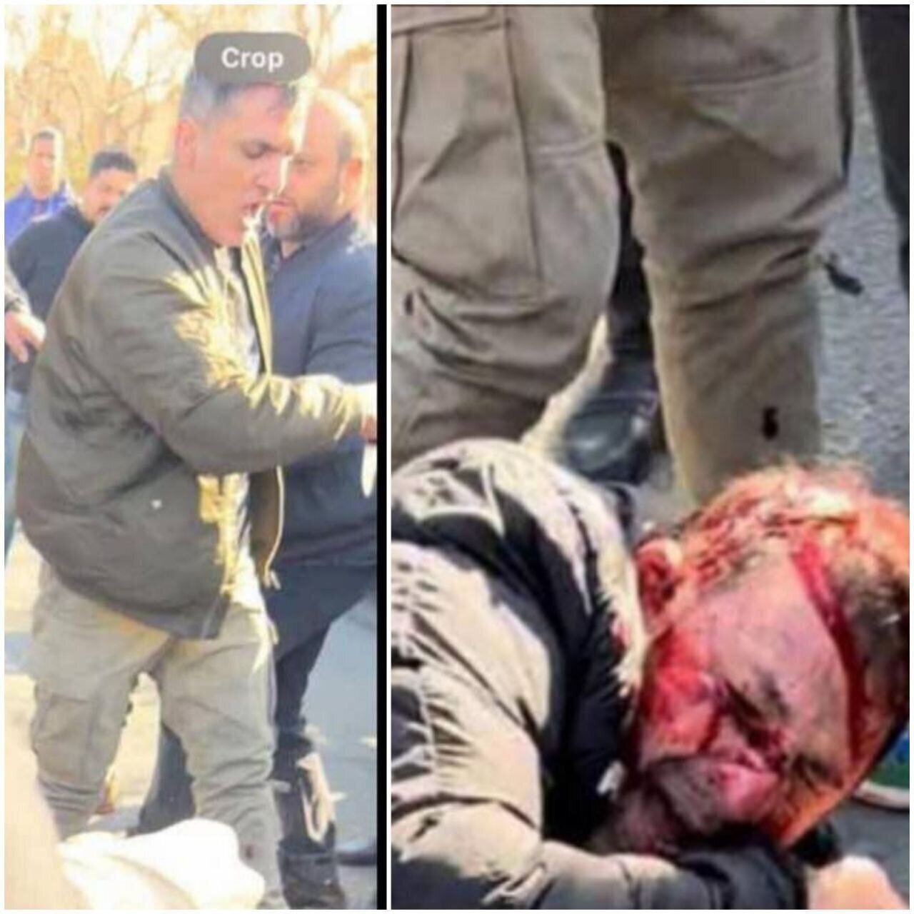 عکس | صورت خونین گنده‌لات تهران پس از درگیری