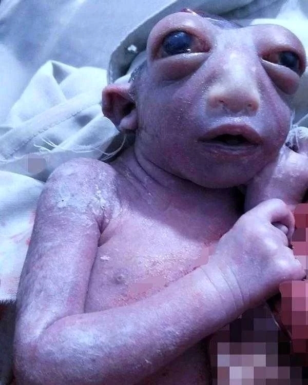 عکس | تولد نوزاد عجیبی که همه را وحشت‌زده کرد