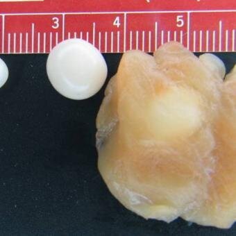 تنها حیوانی که برای زنده ماندن به اکسیژن نیاز ندارد!