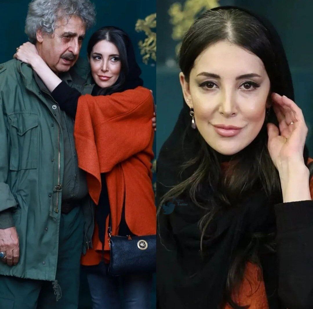 عکس | خطای پزشکی چهره این بازیگر را برای همیشه تغییر داد