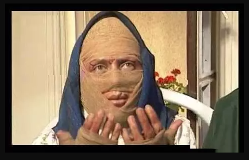 عکس | اسید پاشی به صورت لعیا زنگنه