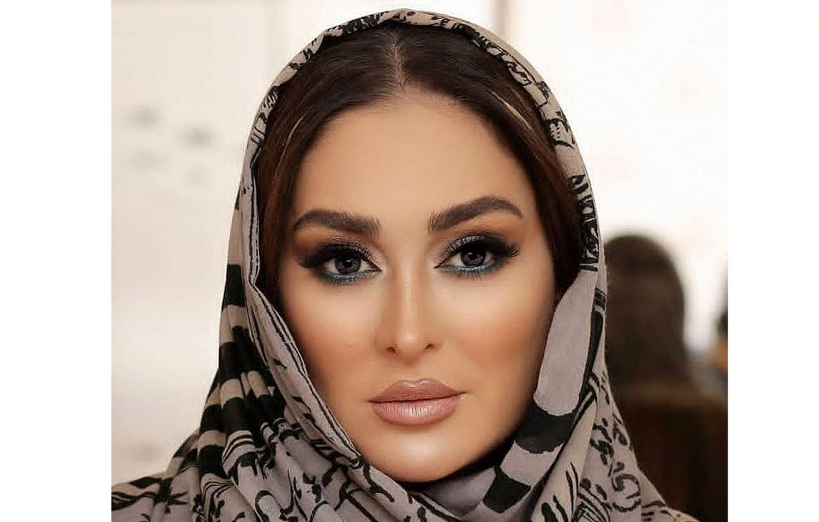 نتیجه عمل‌های زیبایی الهام حمیدی | شوهر دوم کوچکتر و جذابتر خانم بازیگر