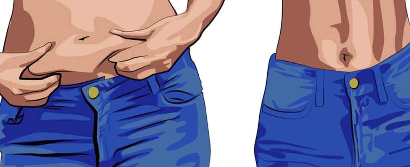 هزینه عمل ابدومینوپلاستی در سال 1403 و عوامل موثر بر آن