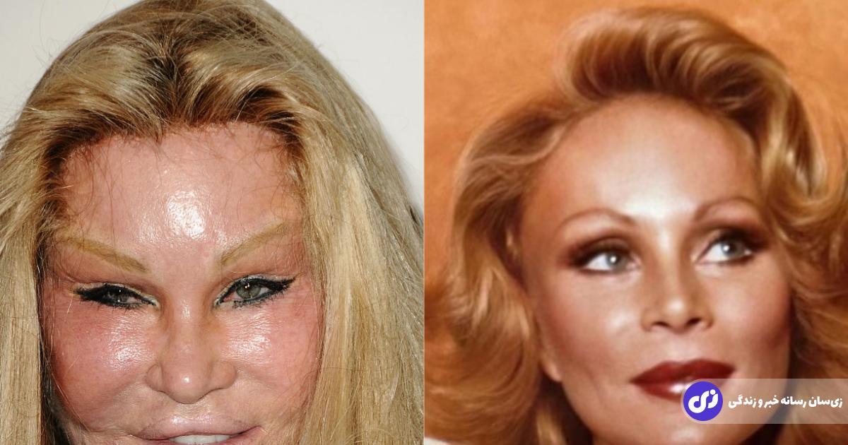 عکس | زنی که به علت علاقه زیاد به گربه با عمل جراحی خود را شبیه آن درآورده بود درگذشت!