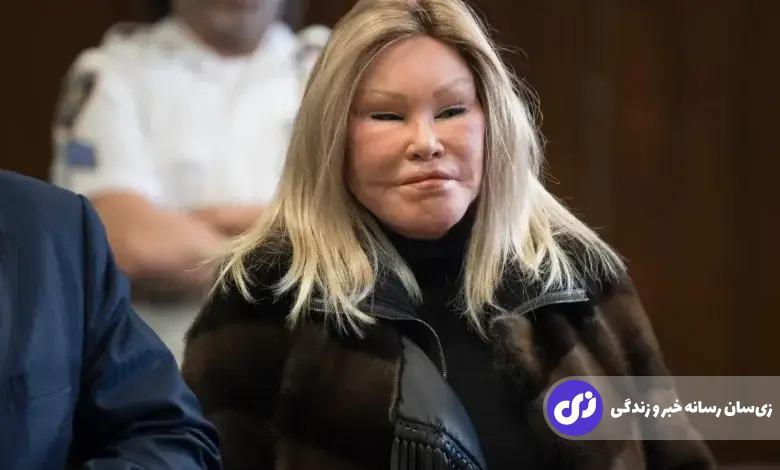 عکس | زنی که به علت علاقه زیاد به گربه با عمل جراحی خود را شبیه آن درآورده بود درگذشت!