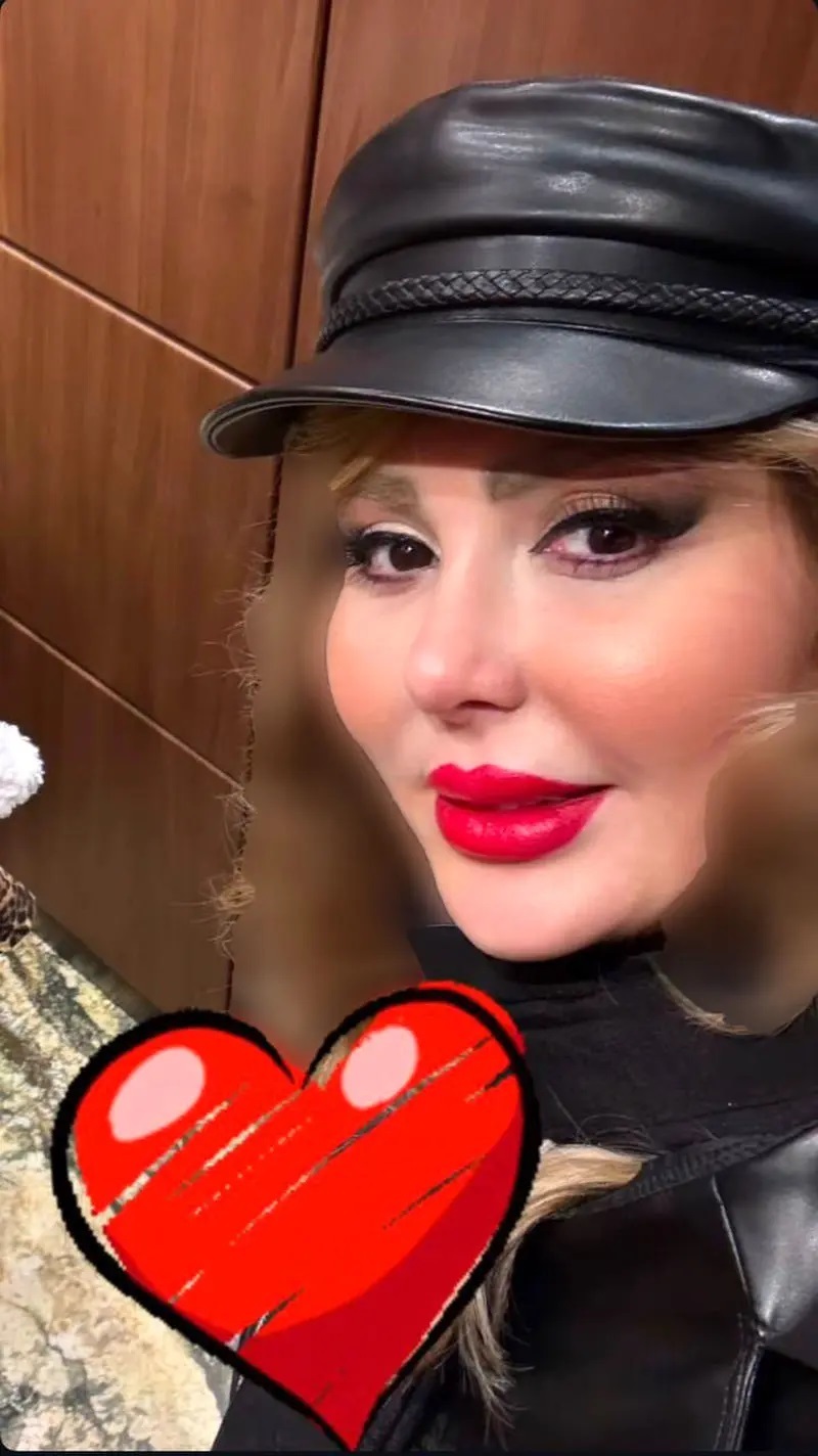 عکس | نیوشا ضیغمی با چهرهای متفاوت پس از جدیدترین عملهای زیبایی / تغییرات جنجالی! عکس | نیوشا ضیغمی با چهرهای متفاوت پس از جدیدترین عملهای زیبایی / تغییرات جنجالی!