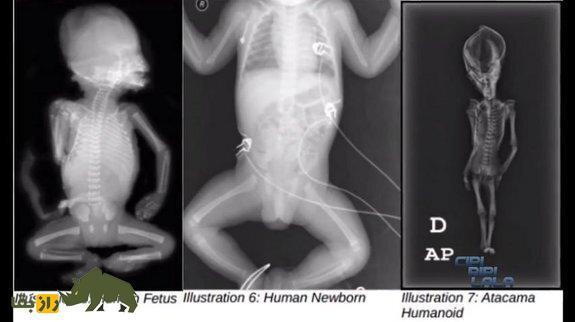 مومیایی عجیب‌ الخلقه آتاکاما مرموزترین معمای جهان شد | اسکلت ترسناک ۱۵ سانتی‌متری آتا