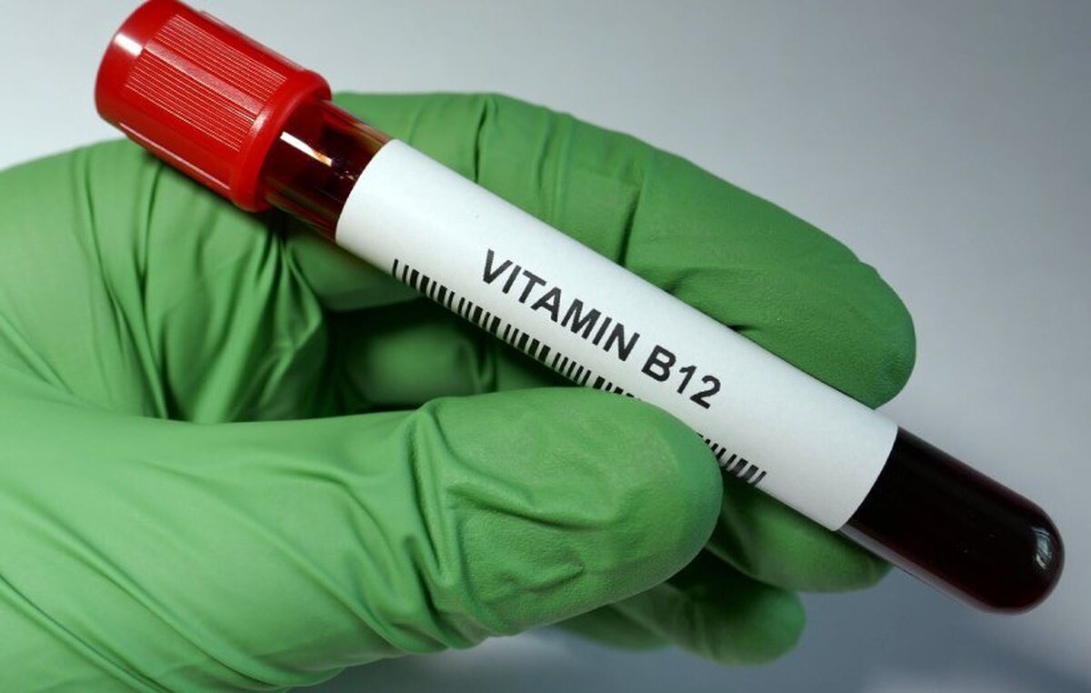 علائم رایج کمبود ویتامین B کدامند ؟