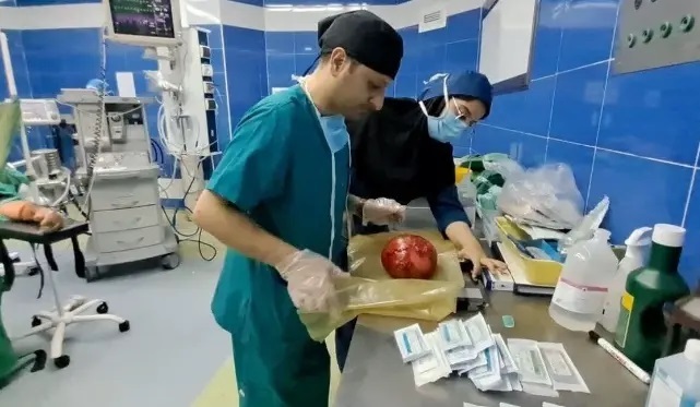 عکس | تومور ۱۱ کیلویی از شکم یک زن خارج شد!