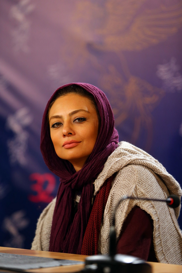 عکس | چهره یکتا ناصر بعد از عمل زیبایی زیر و رو شد!