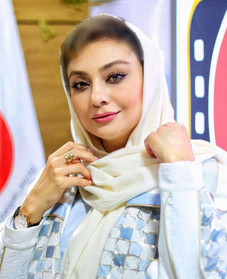 عکس | چهره یکتا ناصر بعد از عمل زیبایی زیر و رو شد!