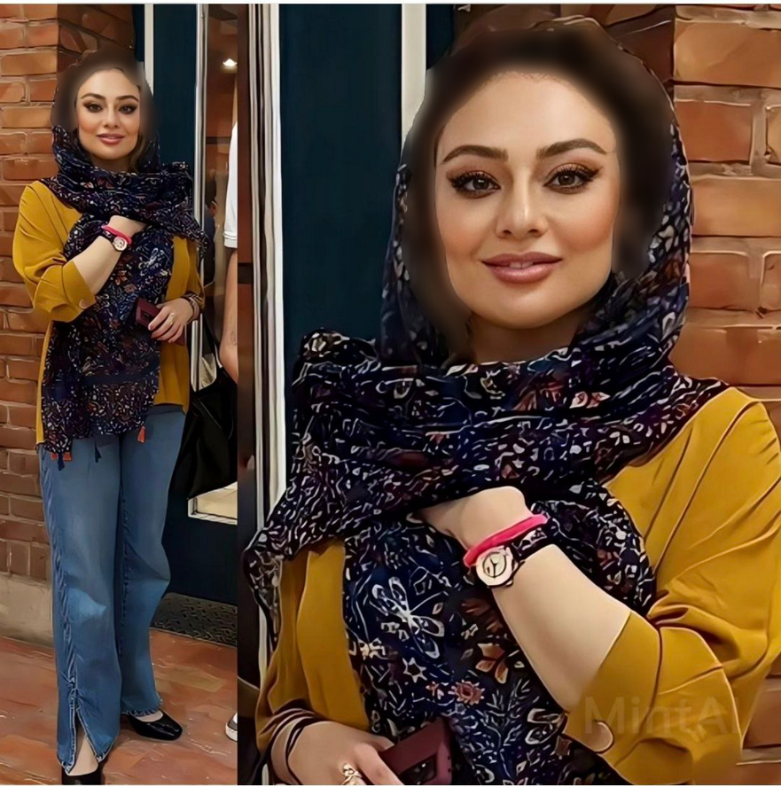 عکس | چهره یکتا ناصر بعد از عمل زیبایی زیر و رو شد!