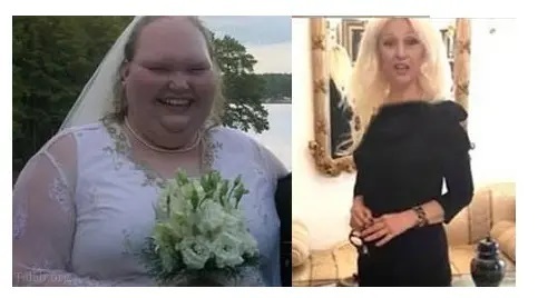 عکس | به این زن می‌گفتند زشت‌ترین عروس دنیا! | چشم همه را به خود خیره کرد!