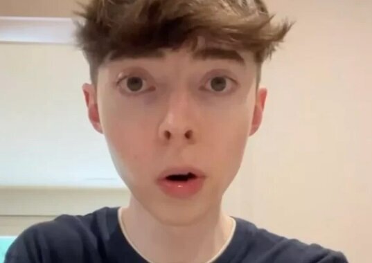 عکس | باورکردنی نیست، اما این مرد ۳۵ سال سن دارد!