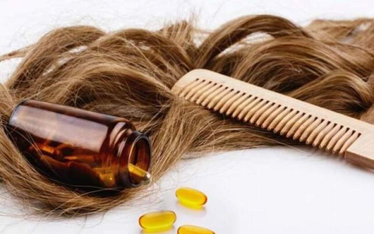 با مصرف این ویتامین‌ها با ریزش مو خداحافظی کنید