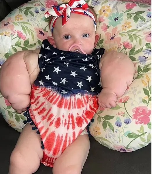 عکس | با دیدن این نوزاد وحشت خواهید کرد!