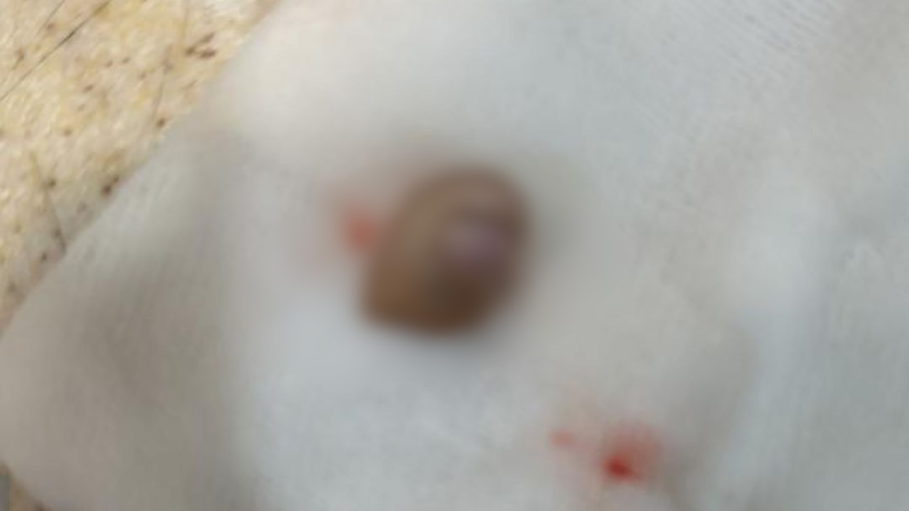 عکس | نقاله مکانیکی فرودگاه انگشت اشاره دختر ۴ ساله را قطع کرد! عکس | نقاله مکانیکی فرودگاه انگشت اشاره دختر ۴ ساله را قطع کرد!