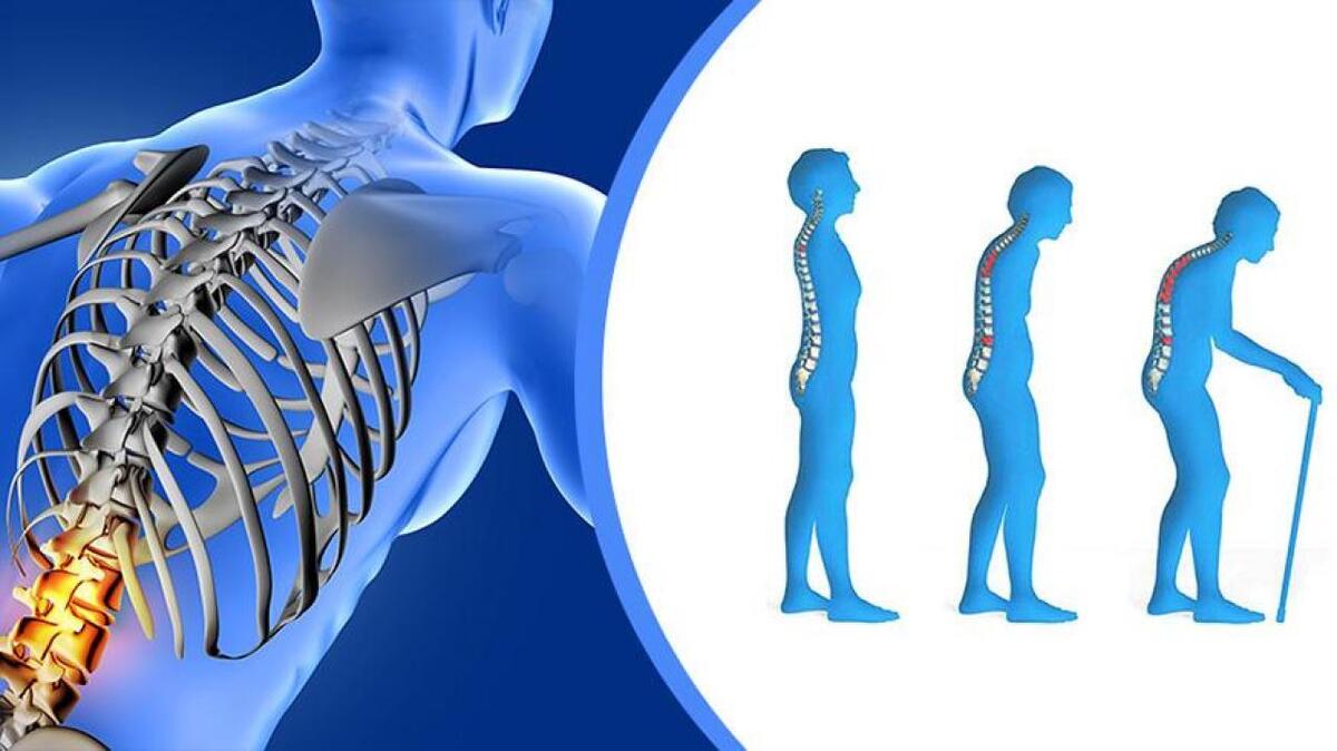 یک روش ساده برای تقویت استخوان‌ها