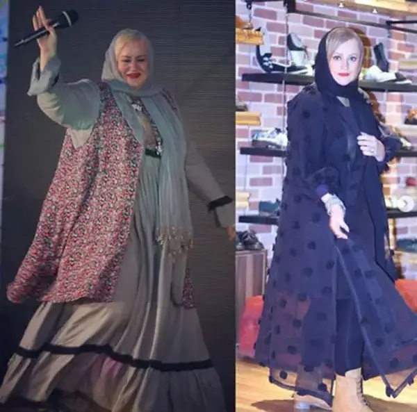 چرا عمل لاغری باعث چاقی بیشتر نعیمه نظام دوست شد؟! چرا عمل لاغری باعث چاقی بیشتر نعیمه نظام دوست شد؟!