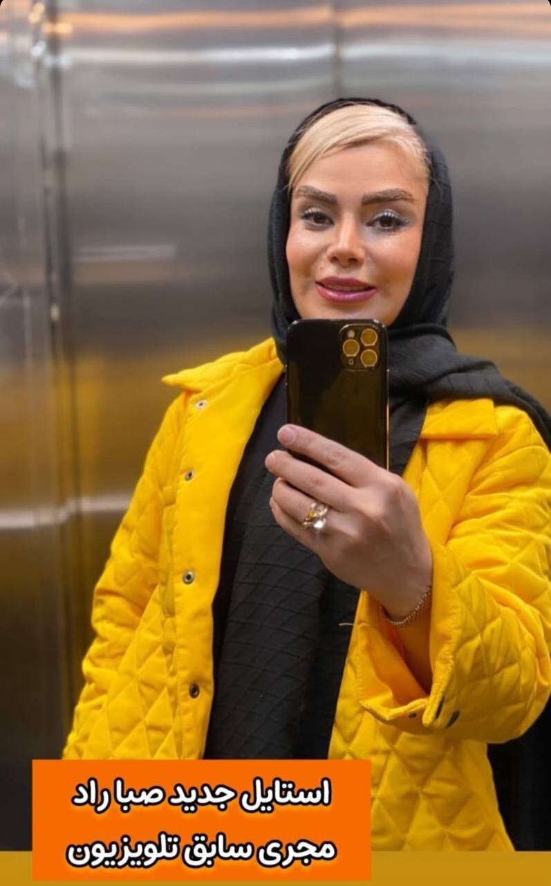 عکس | چهره مجری مشهور تلویزیون بعد از جراحی‌های زیبایی کاملا عوض شد!