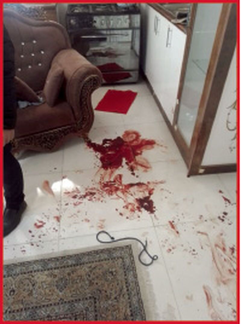 عکس | مردی که سارق منزلش را با خنجر از پا در آورد! | دزد همسایه طبقه پایین بود! | حاوی تصاویر دلخراش!