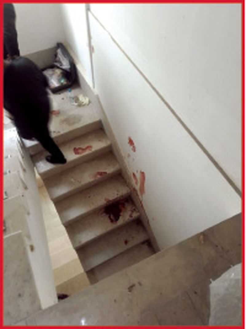 عکس | مردی که سارق منزلش را با خنجر از پا در آورد! | دزد همسایه طبقه پایین بود! | حاوی تصاویر دلخراش!