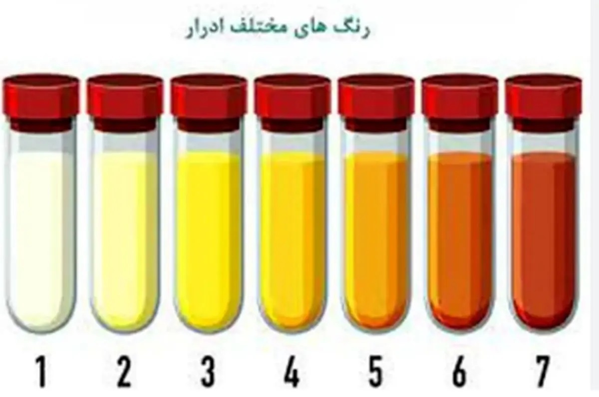 رنگ ادرار شما نشانه‌ی کدام بیماری است؟