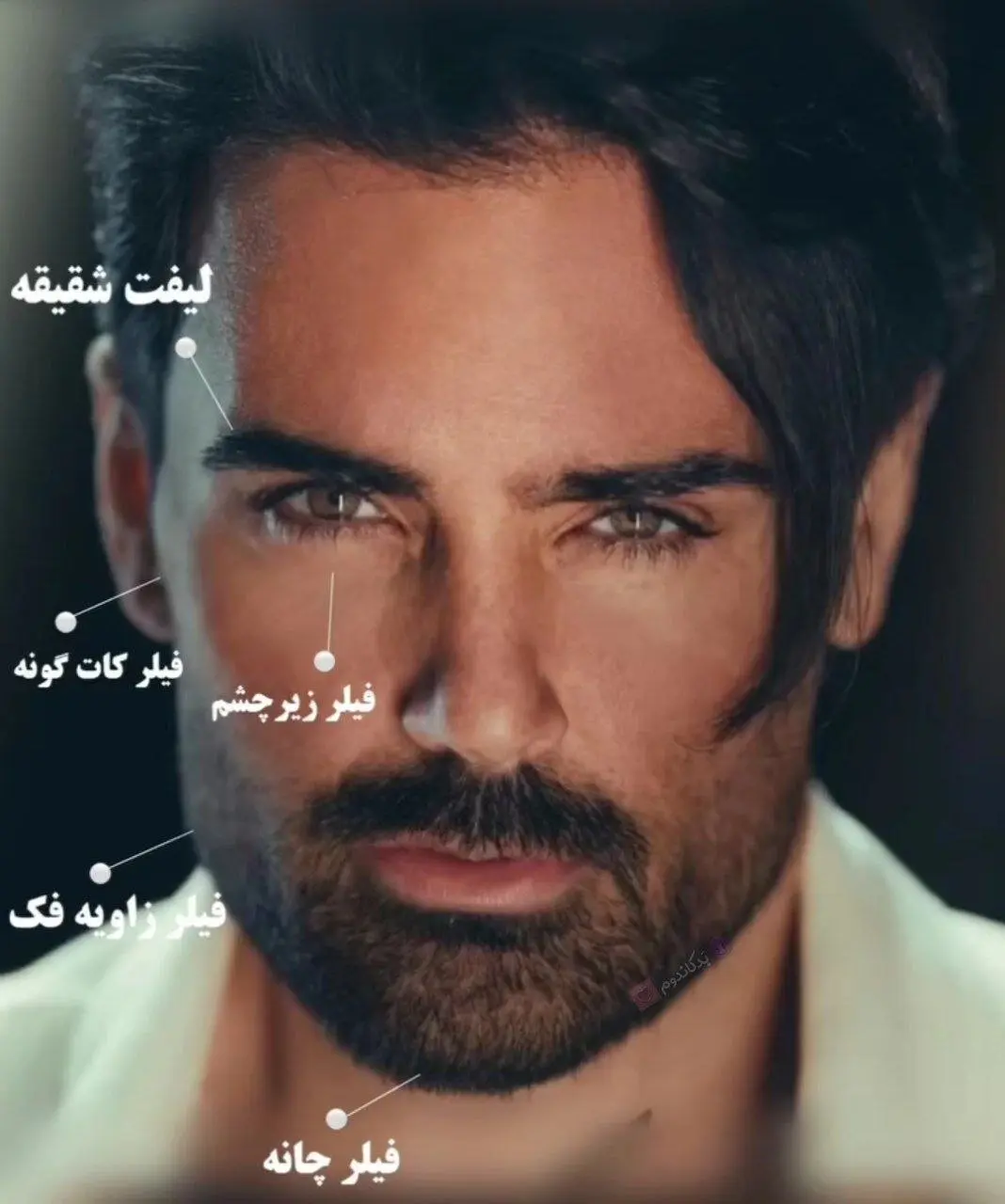 عکس | سهراب پاکزاد قبل و بعد از جراحیهای زیبایی! باور نکردنی است! عکس | سهراب پاکزاد قبل و بعد از جراحیهای زیبایی! باور نکردنی است!