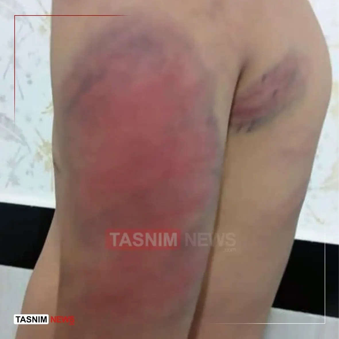 عکس | تکلیف معلم سنندجی که دانش‌آموزان را کتک می‌زد چه شد؟