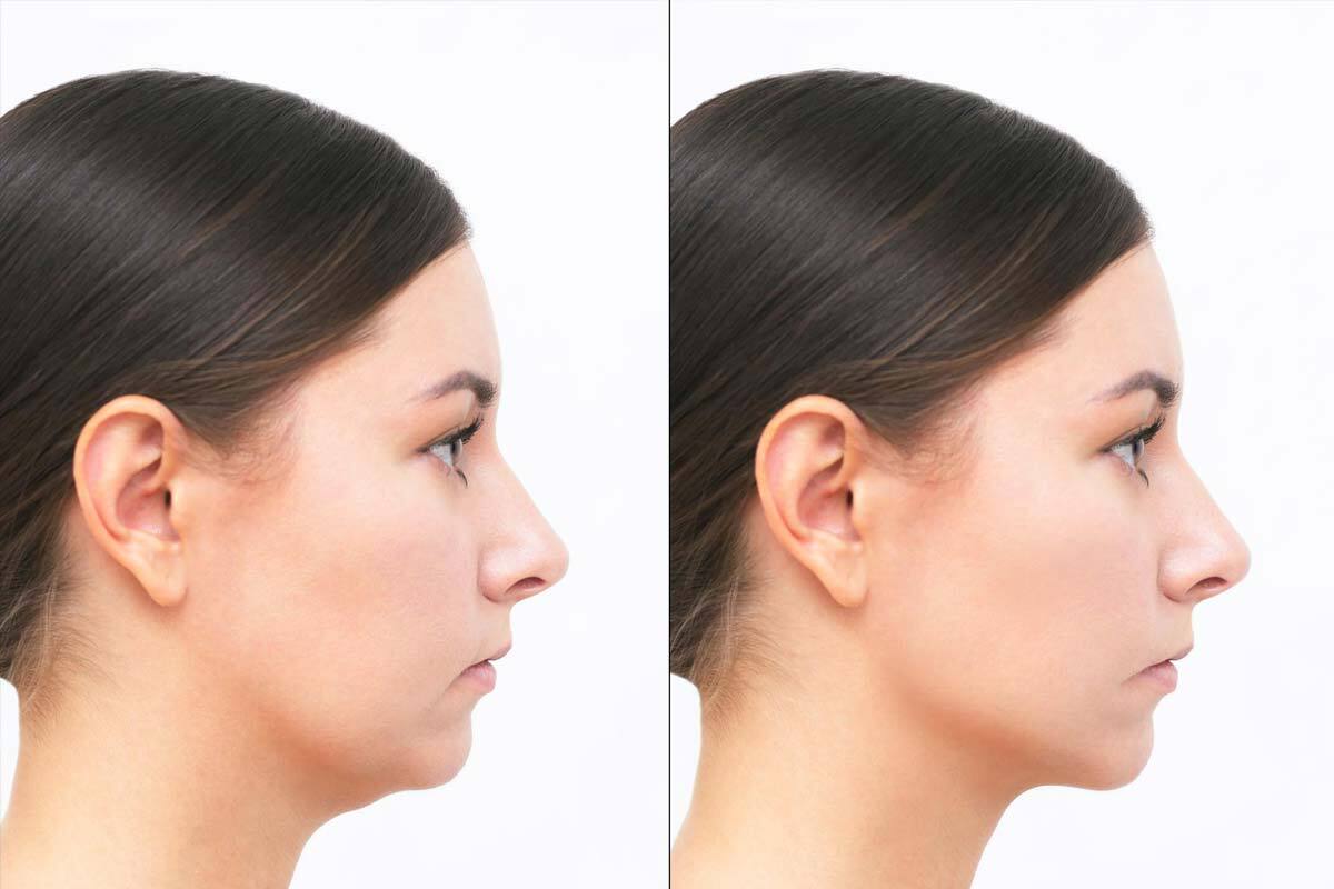 چه زمانی نیاز به ارتودنسی داریم ؟ نشانه‌هایی که نباید نادیده بگیرید