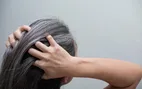 پژوهش تازه درباره علت سفیدن شدن مو